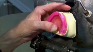 Изготовление зубных протезов