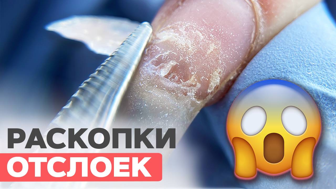 ЖУТКИЕ ОТСЛОЙКИ | Почему плохо носится покрытие? смотреть онлайн