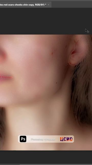 Туториал по Photoshop "убрать акне" (ЦСИО) смотреть онлайн