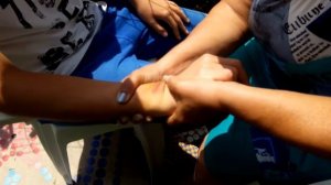 Твист терапия.  Лечение лучезапястного сустава.