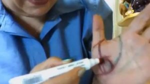 СУ - ДЖОК НА ПОМОЩЬ СЕРДЦУ 1.