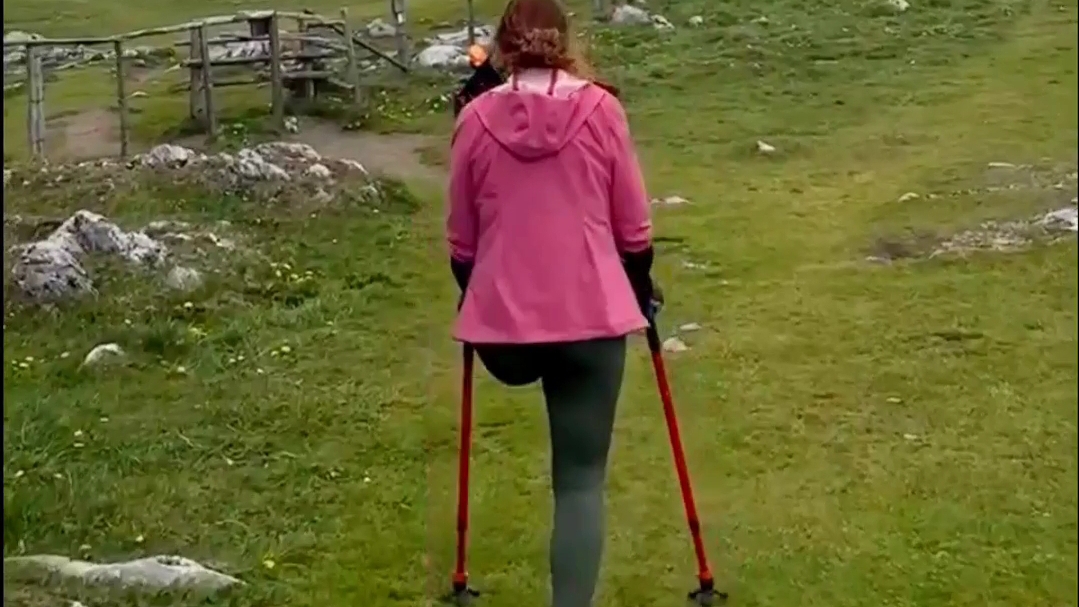 Amputee Lak смотреть онлайн