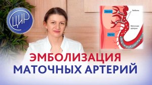Эмболизация маточных артерий - это приговор? Дементьева Светлана Николаевна.