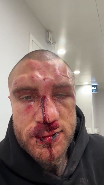 Эксклюзив! Первые кадры Alex Terrible после боя смотреть онлайн