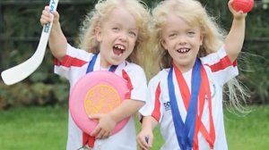 Эти редкие близнецы удивят даже взрослых!