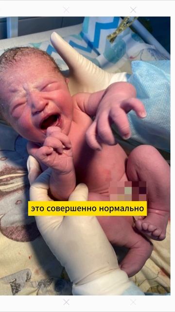 Стоит ли пугаться фиолетового цвета кожи у малыша? смотреть онлайн