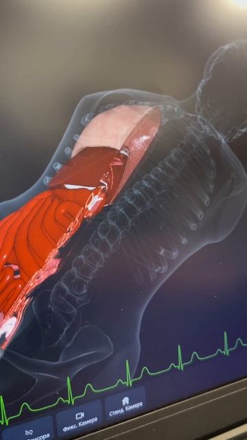 Что врачи делают с этим необычным аппаратом? смотреть онлайн