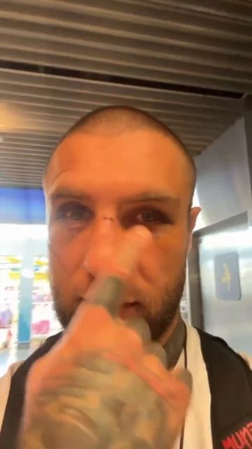 Alex Terrible Talks Post-Fight Damage… It’s Serious смотреть онлайн