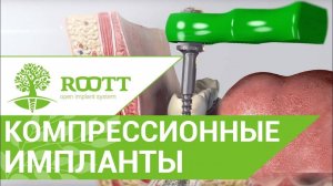 Пример операции с применением компрессионного имплантата, системы имплантации ROOTT (рут, root)