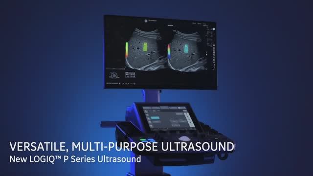 GE LOGIQ P Series смотреть онлайн