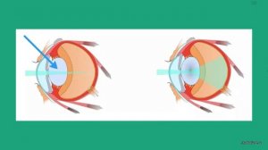 Орган зрения. Анатомия и физиология глаза. Болезни. Лекция и разбор заданий от Юрия Беллевича