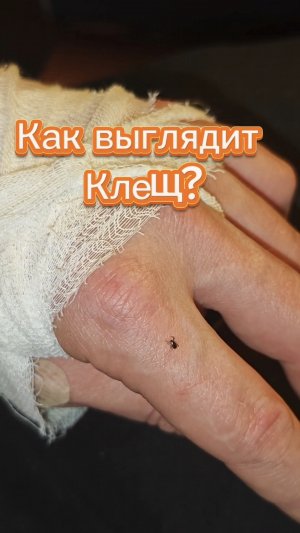 Как выглядит клещ