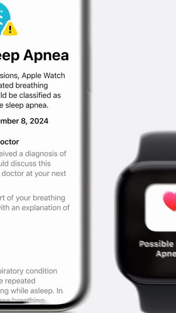 Слухи об Apple Watch 11-й серии 👀 смотреть онлайн