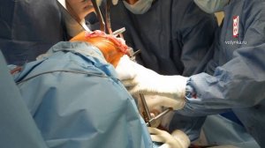 Эндопротезирование коленного сустава