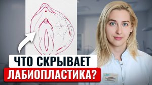 Что скрывает лабиопластика?