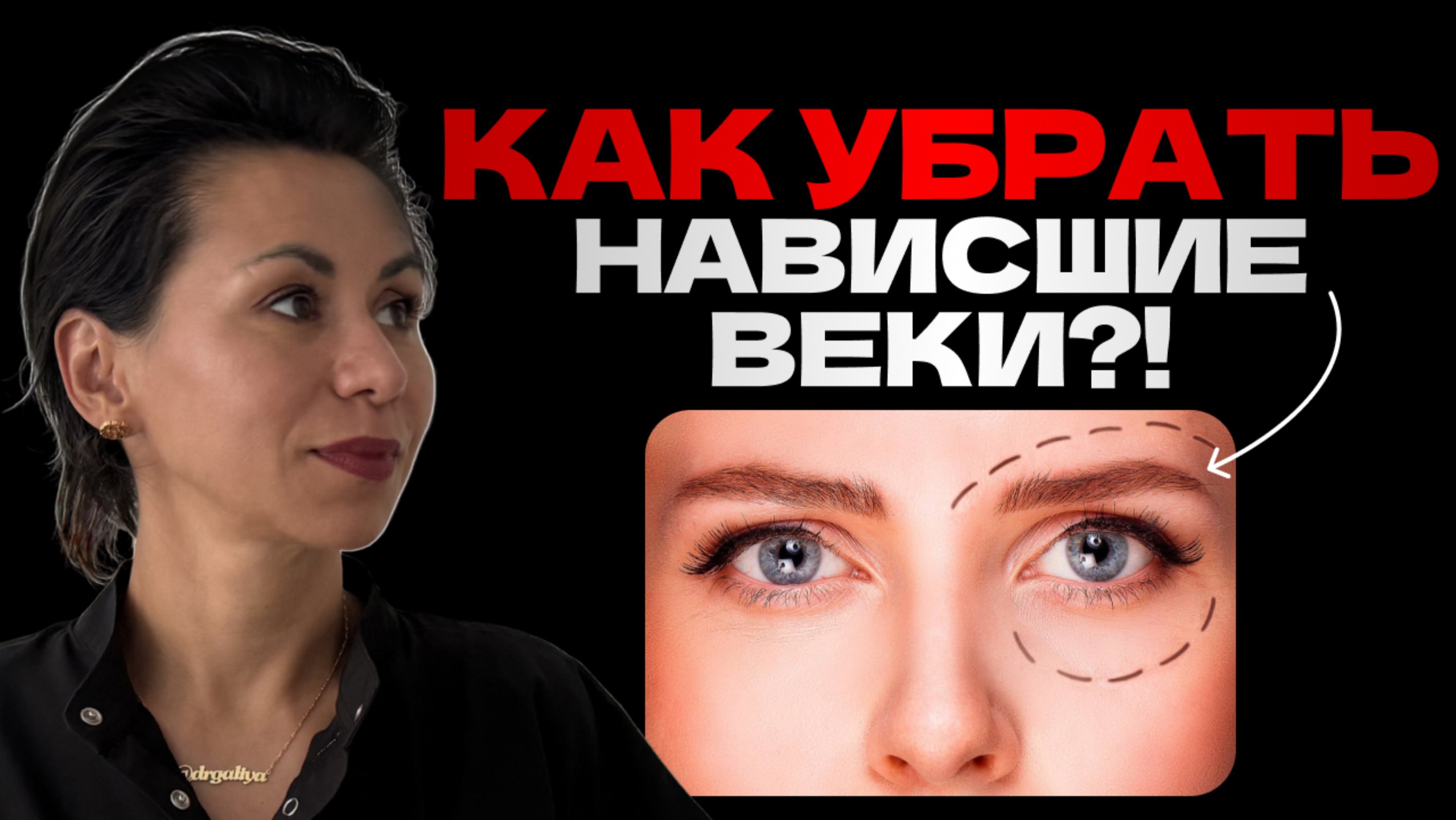 БЛЕФАРОПЛАСТИКА верхних век: как вернуть свежесть взгляду?!