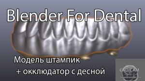 2) Модель штампик + окклюдатор с десной