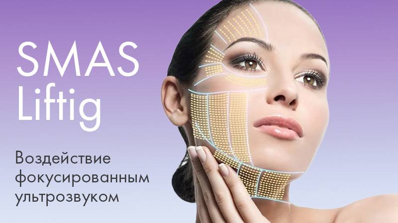 Ультразвуковой SMAS-лифтинг за одну процедуру смотреть онлайн