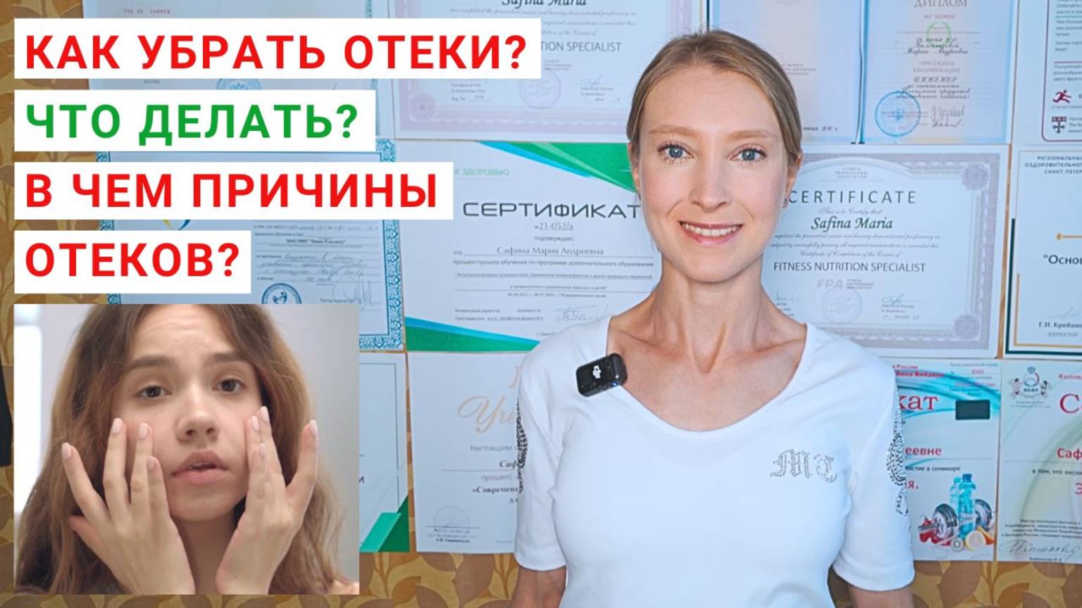 КАК УБРАТЬ ОТЕКИ? Как похудеть и снять отеки? Как вывести воду из организма? Причины отеков. смотреть онлайн