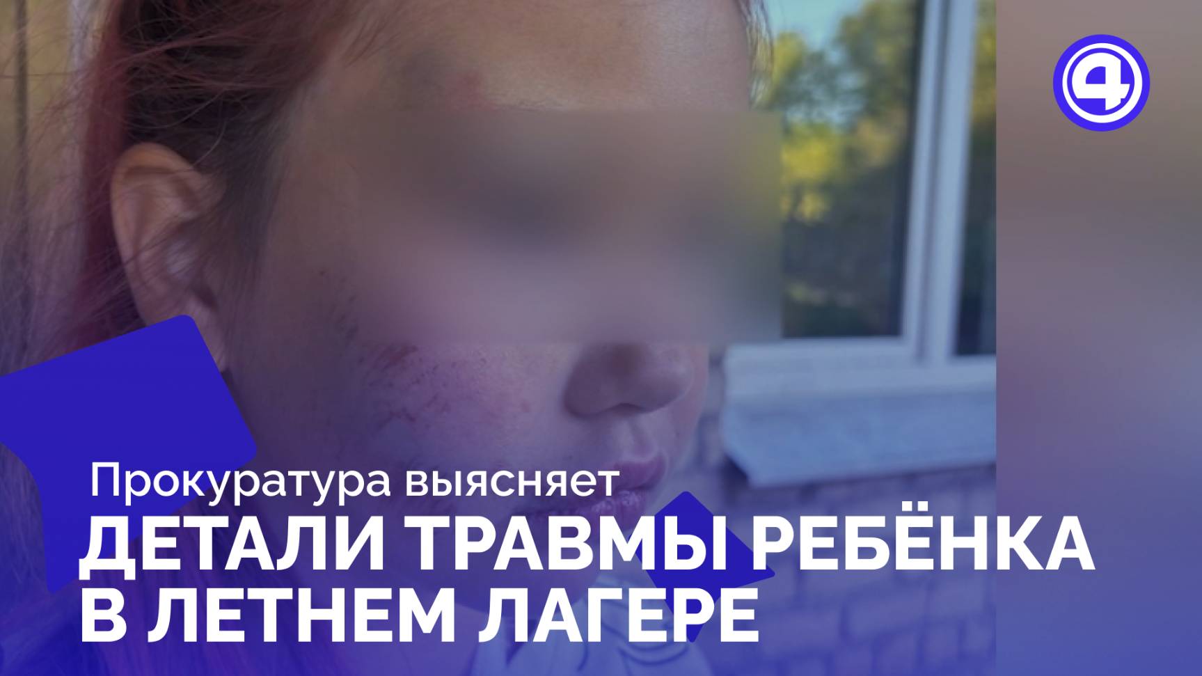 Травма на игровой площадке стала поводом для прокурорской проверки смотреть онлайн