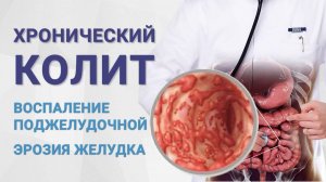Хронический колит, воспаление поджелудочной, эрозия желудка