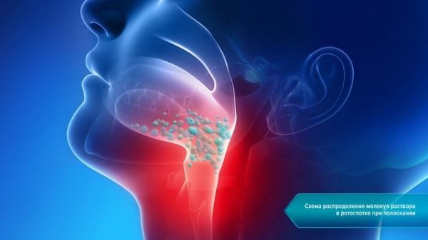 ОКИ Раствор