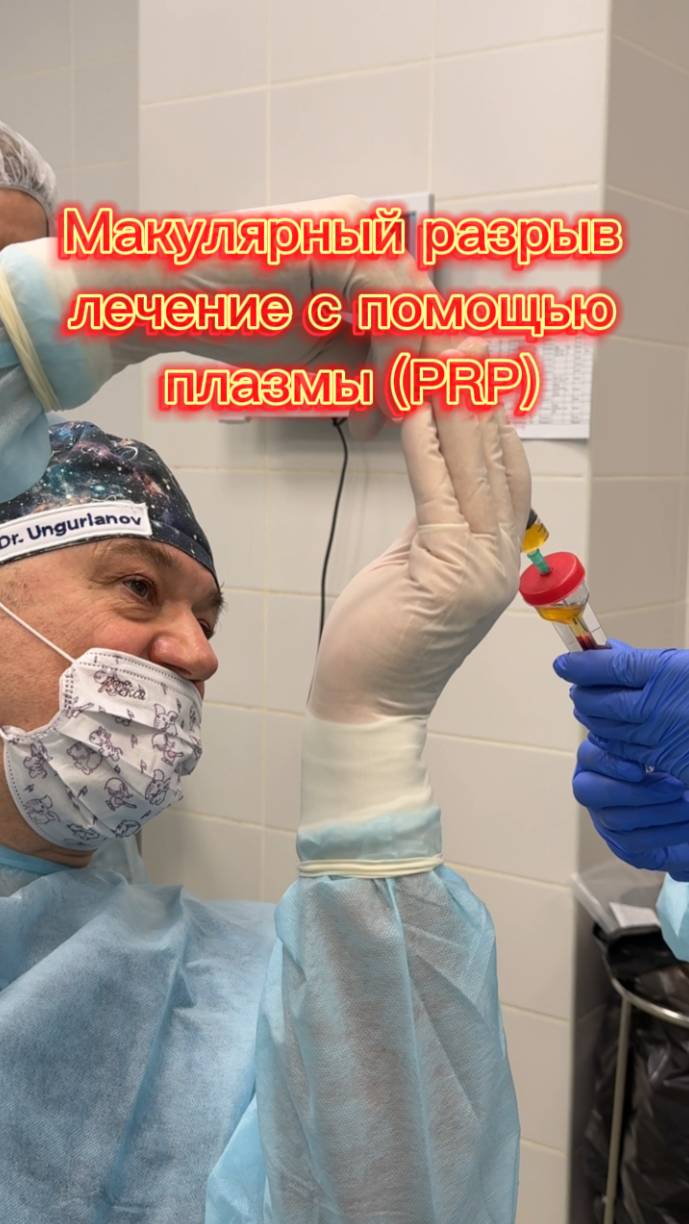 Лечение макулярного разрыва сетчатки глаза плазмой пациента. Зрение можно спасти. смотреть онлайн