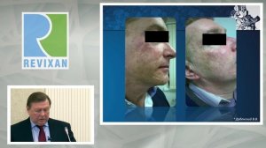 ФОТОДИНАМИЧЕСКАЯ ТЕРАПИЯ | МАСТЕР-КЛАСС