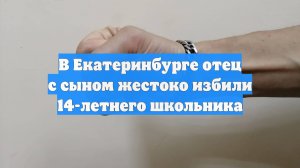 В Екатеринбурге отец с сыном жестоко избили 14-летнего школьника