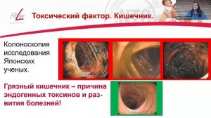 ЧАС ЗДОРОВЬЯ | Профилактика онкологии в 21 веке!