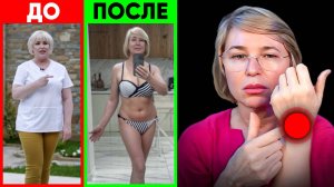 ➡️ Откуда берутся целлюлит, обвисший живот, грудь, пролапсы, недержание и отёки?