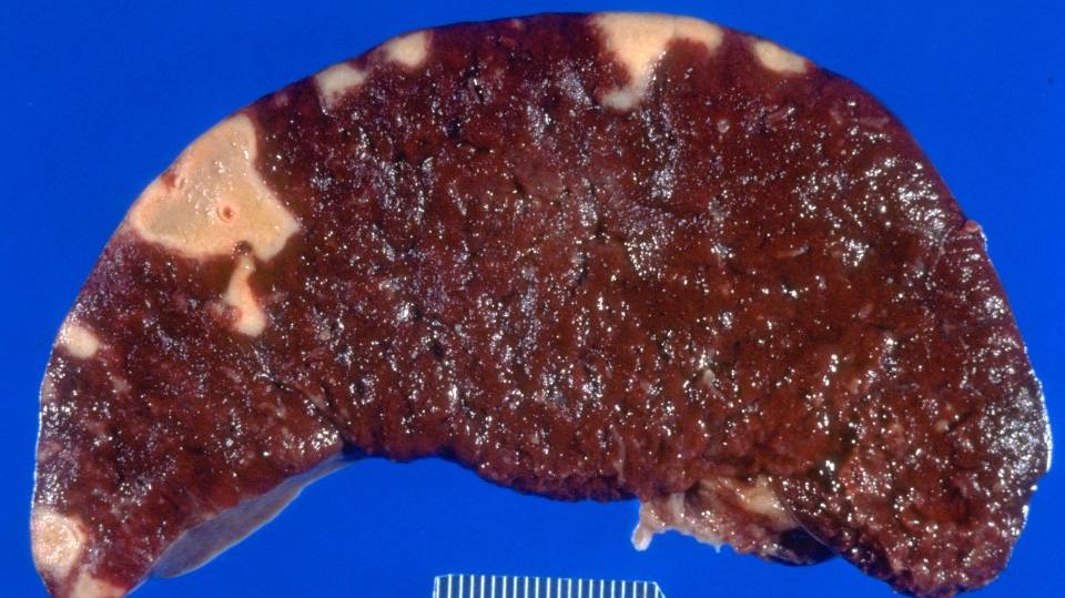 Введение. Некроз. Апоптоз смотреть онлайн