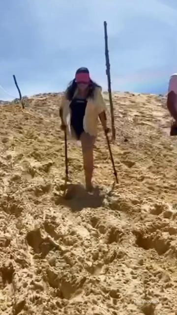 Amputee Rhd смотреть онлайн