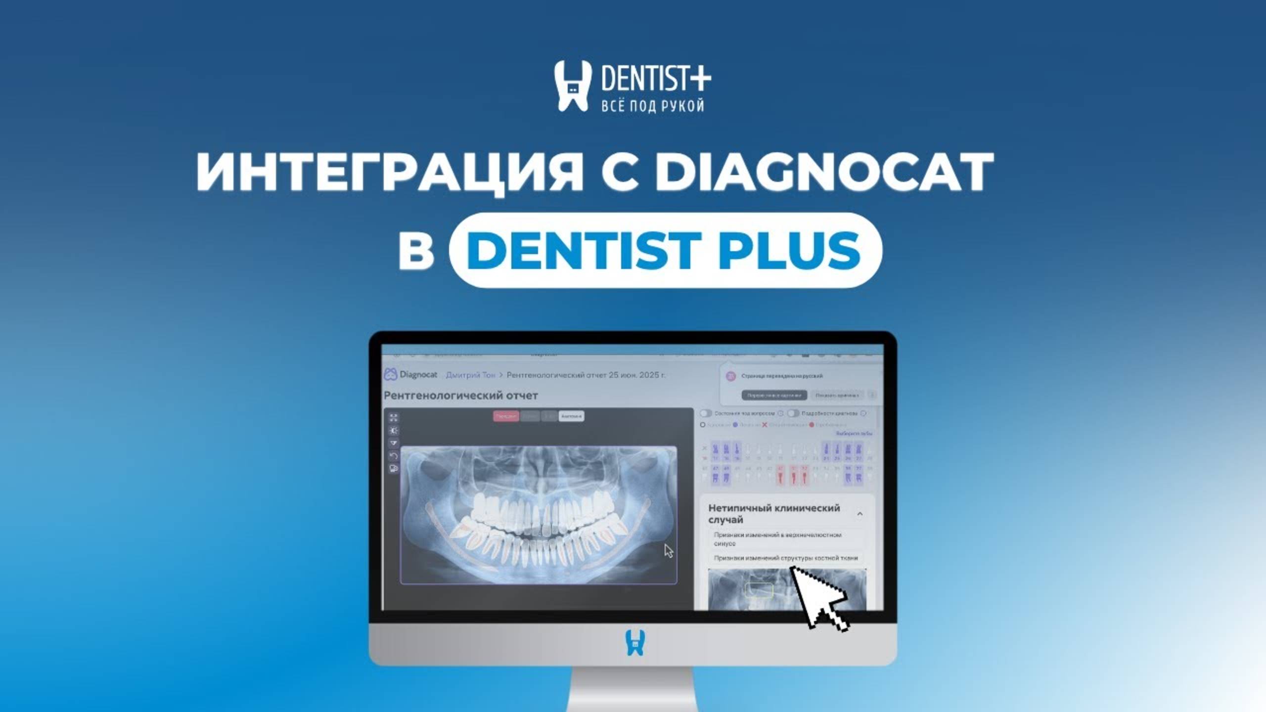 Интеграция с Diagnocat: как загружать и расшифровывать снимки прямо из карточки пациента | Dentist+ смотреть онлайн