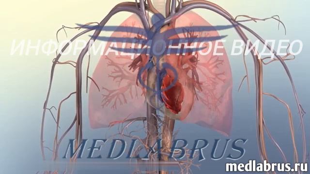 Левосторонняя сердечная недостаточность