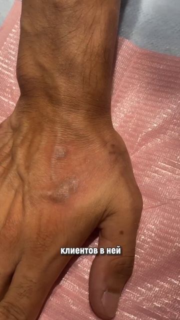 На какие процедуры по камуфляжу самый большой спрос?