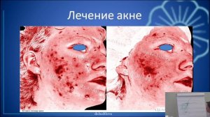 Обучение методике ФДТ REVIXAN от Индиловой Натальи Ильгизаровны от 24.05.2021