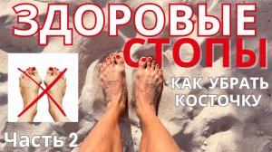 Здоровые стопы 2 часть. Как убрать косточку на стопе. Тренировка для ног. Упражнения для стоп