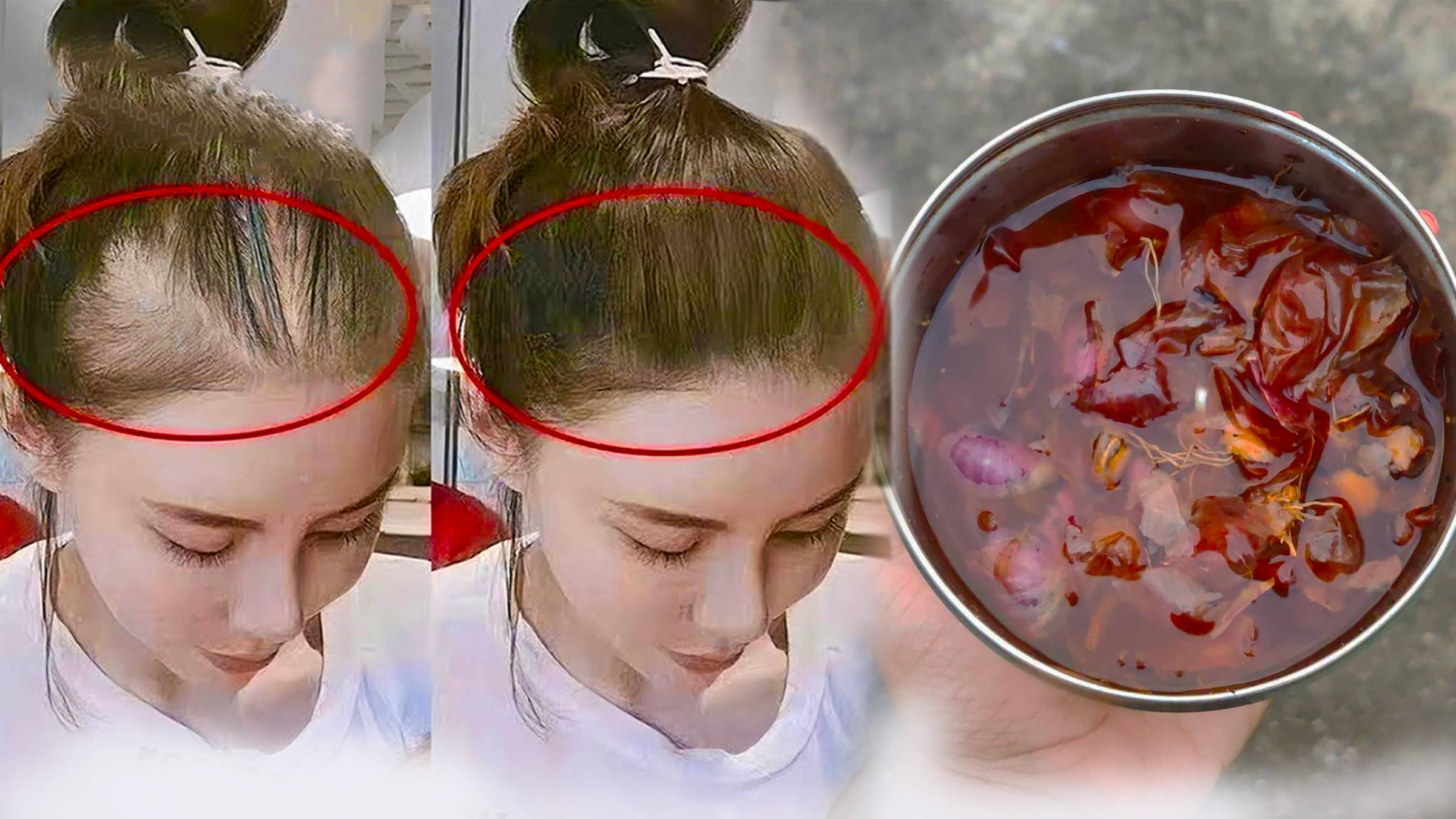 Волосы растут как сумасшедшие и НЕ ВЫПАДАЮТ! Сильная маска от выпадения волос спасла волосы! смотреть онлайн