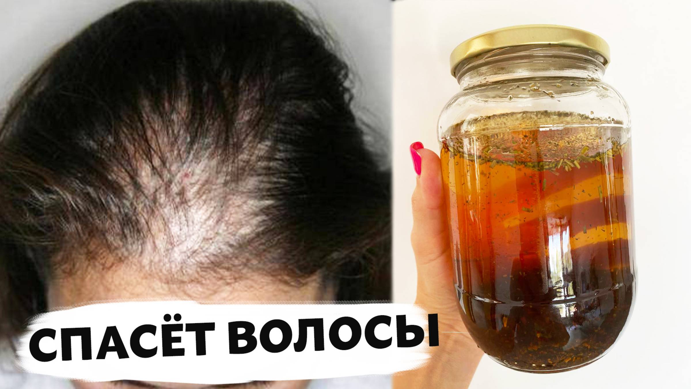 Сильный КОНЦЕНТРАТ от ВЫПАДЕНИЯ ВОЛОС! Просто Добавь в ШАМПУНЬ / Быстрый Рост и ЛЕЧЕНИЕ ОБЛЫСЕНИЯ смотреть онлайн