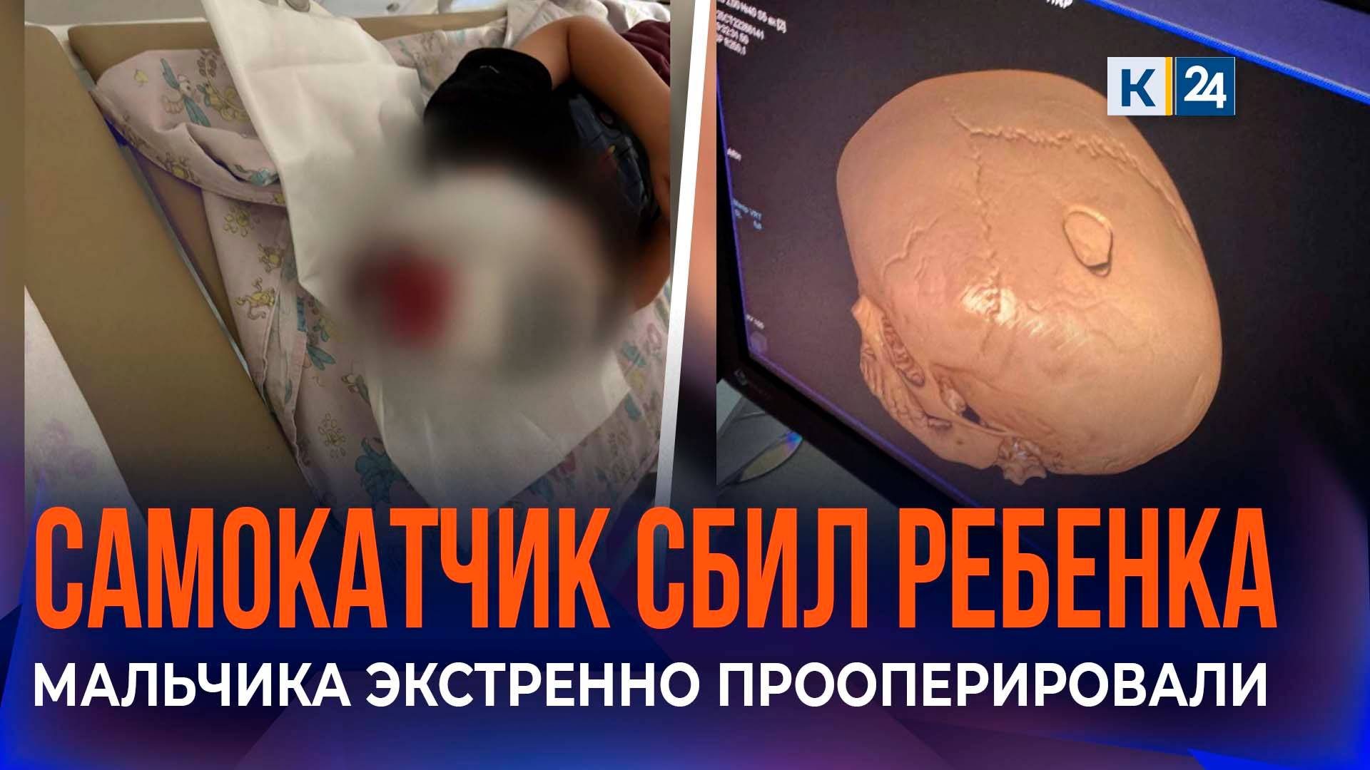 Мать сбитого самокатом 4-летнего мальчика в Краснодаре рассказала о ДТП смотреть онлайн