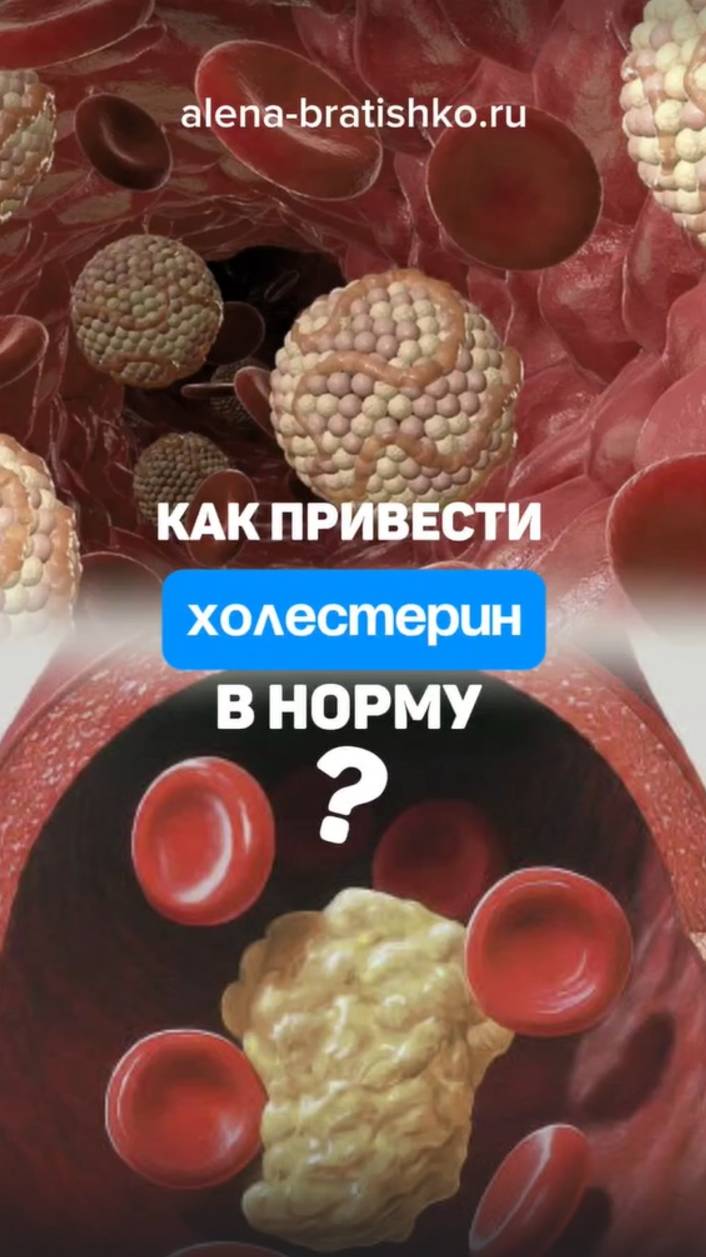 Как снизить холестерин? Алена Братишко смотреть онлайн