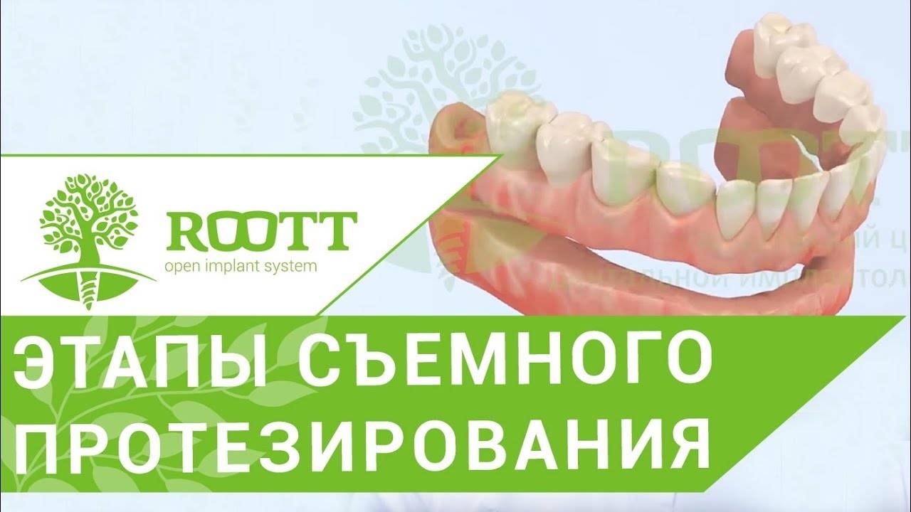 Съемное протезирование. Этапы съемного протезирования зубов при пародонтите. смотреть онлайн