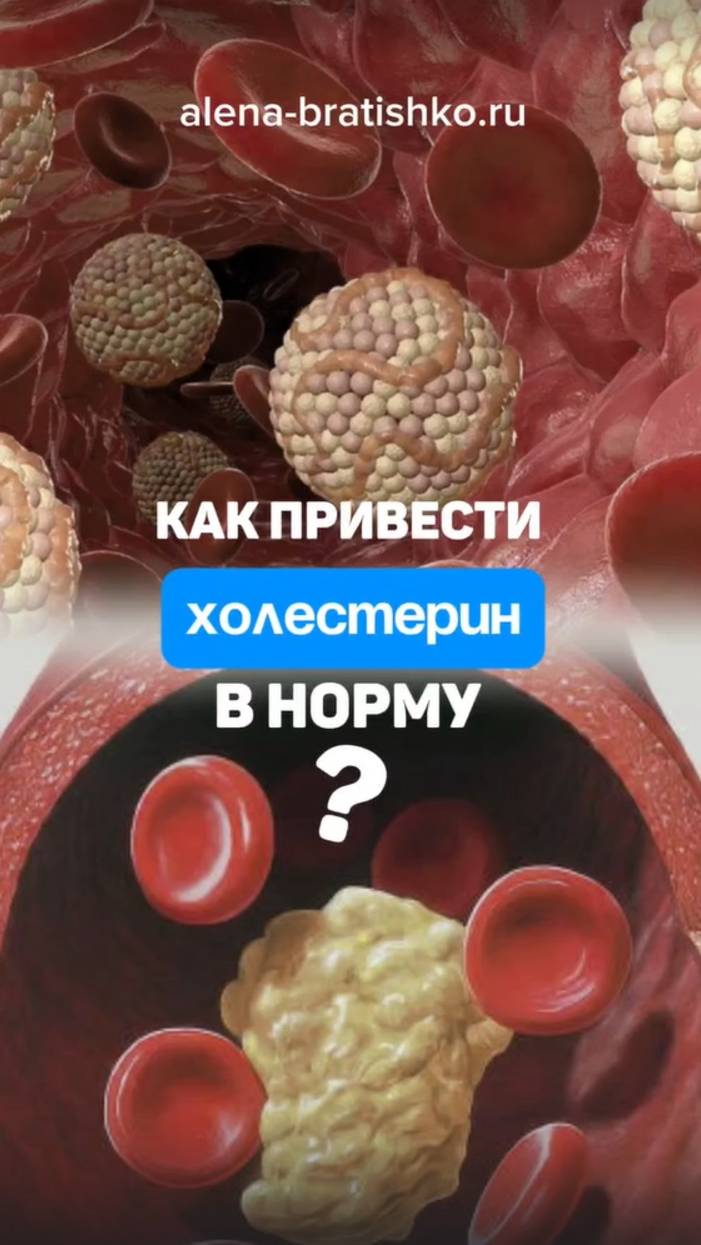 Как снизить холестерин? Что делать, чтобы привести холестерин в норму? Алена Братишко смотреть онлайн