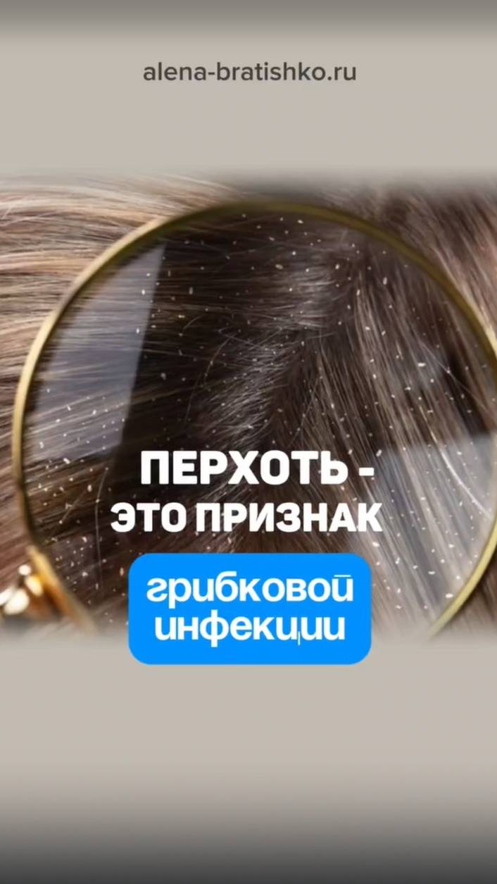Перхоть - это признак грибковой инфекции в организме. Алена Братишко смотреть онлайн