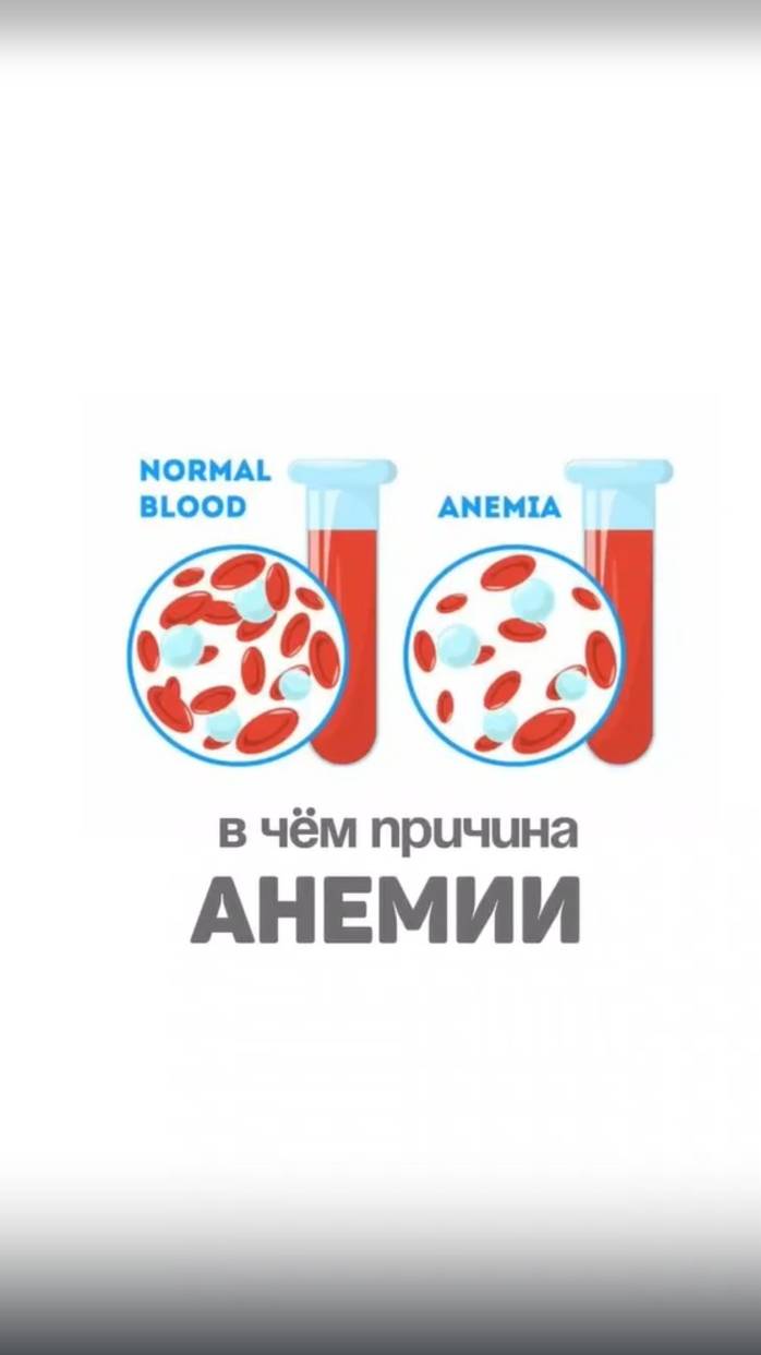 Почему и как появляется железодефицитная анемия. Виды анемий и их причины. Алена Братишко смотреть онлайн