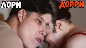 Что стало с девушками, которые срослись между собой?!