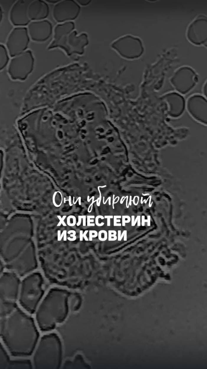 Лейкоциты и холестерин в крови смотреть онлайн