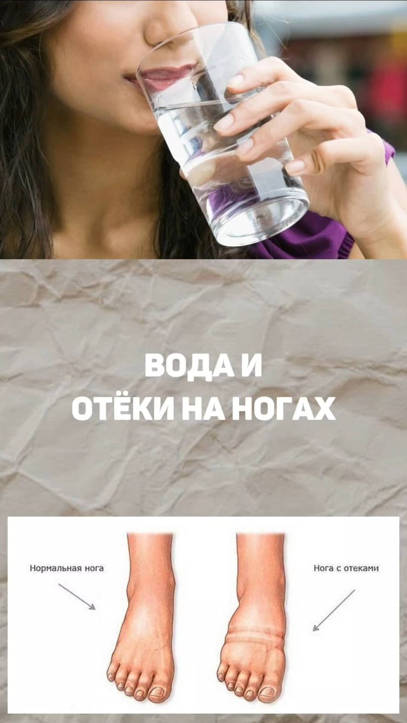 Вода и отеки на ногах смотреть онлайн