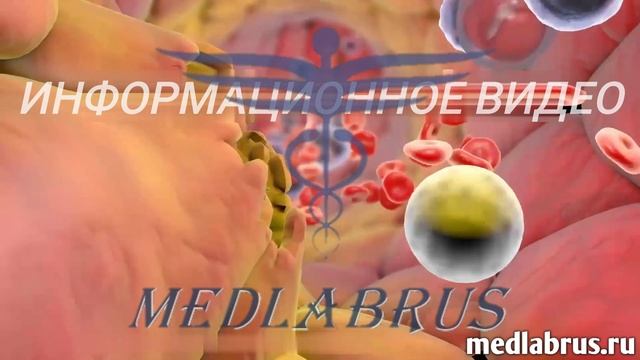 Ишемическая болезнь сердца (ИБС) как сохранить здоровье сердца смотреть онлайн